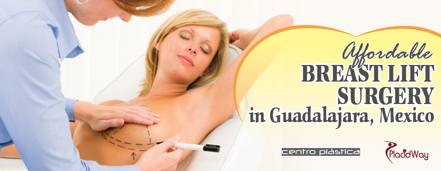 Affordable Breast Lift Surgery in Guadalajara, Mexico